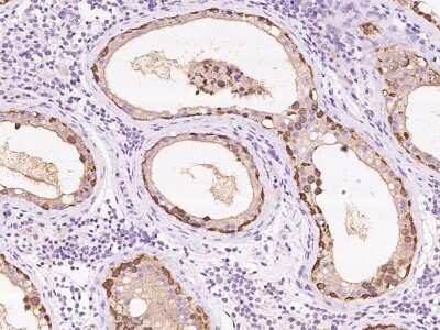 Immunohistochemistry-Paraffin: Ribonuclease Inhibitor Antibody [NBP2-99628] - Immunochemical staining of human Ribonuclease Inhibitor in human testis with rabbit polyclonal antibody at 1:2000 dilution, formalin-fixed paraffin embedded sections.