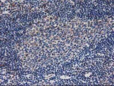 Immunohistochemistry: Ribonuclease Inhibitor Antibody (OTI1B7) - Azide and BSA Free [NBP2-73896] - Staining of paraffin-embedded Human lymph node tissue using anti-Ribonuclease Inhibitor mouse monoclonal antibody.