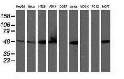 Western Blot: Ribonuclease Inhibitor Antibody (OTI1B7) - Azide and BSA Free [NBP2-73896] - Analysis of extracts (35ug) from 9 different cell lines by using anti-Ribonuclease Inhibitor monoclonal antibody.