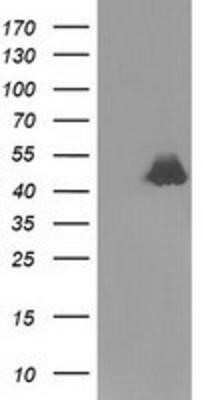 Western Blot: Ribonuclease Inhibitor Antibody (OTI1B7) - Azide and BSA Free [NBP2-73896] - HEK293T cells were transfected with the pCMV6-ENTRY control (Left lane) or pCMV6-ENTRY Ribonuclease Inhibitor (Right lane) cDNA for 48 hrs and lysed. Equivalent amounts of cell lysates (5 ug per lane) were separated by SDS-PAGE and immunoblotted with anti