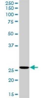 Western Blot: Ribonuclease Inhibitor Antibody [H00006050-D01P] - Analysis of RNH1 expression in mouse spleen.