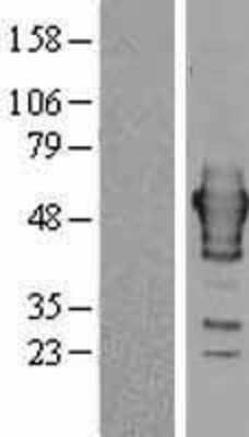 Western Blot: Ribonuclease Inhibitor Overexpression Lysate (Adult Normal) [NBL1-15462] Left-Empty vector transfected control cell lysate (HEK293 cell lysate); Right -Over-expression Lysate for Ribonuclease Inhibitor.