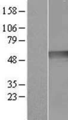 Western Blot: Ribonuclease Inhibitor Overexpression Lysate (Adult Normal) [NBL1-15463] Left-Empty vector transfected control cell lysate (HEK293 cell lysate); Right -Over-expression Lysate for Ribonuclease Inhibitor.