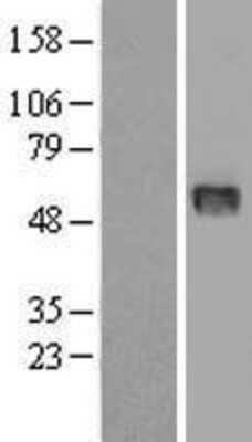 Western Blot: Ribonuclease Inhibitor Overexpression Lysate (Adult Normal) [NBL1-15465] Left-Empty vector transfected control cell lysate (HEK293 cell lysate); Right -Over-expression Lysate for Ribonuclease Inhibitor.