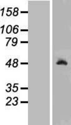 Western Blot: Ribonuclease Inhibitor Overexpression Lysate (Adult Normal) [NBL1-15466] Left-Empty vector transfected control cell lysate (HEK293 cell lysate); Right -Over-expression Lysate for Ribonuclease Inhibitor.