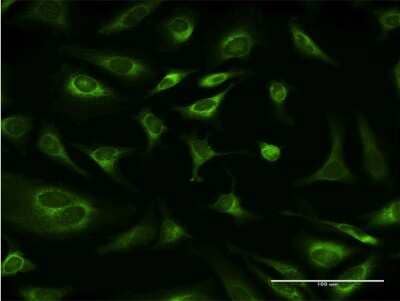 Immunocytochemistry/Immunofluorescence: Ribophorin I Antibody (4B1-1E6) [H00006184-M03] - Analysis of monoclonal antibody to RPN1 on HeLa cell. Antibody concentration 10 ug/ml