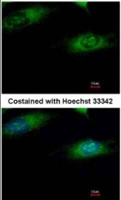 Immunocytochemistry/Immunofluorescence: Ribophorin I Antibody [NBP1-32704] - Analysis of methanol-fixed HeLa, using antibody at 1:500 dilution.