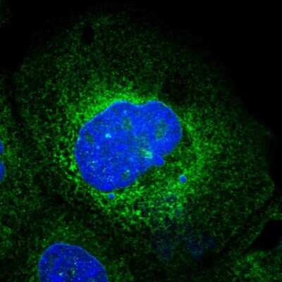 Immunocytochemistry/Immunofluorescence: Ribophorin I Antibody [NBP1-82467] - Staining of human cell line A-431 shows localization to endoplasmic reticulum.