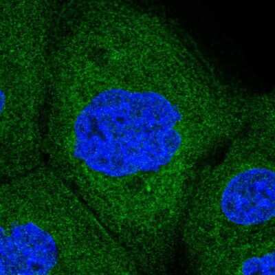 Immunocytochemistry/Immunofluorescence: Ribophorin I Antibody [NBP2-55523] - Staining of human cell line A-431 shows localization to endoplasmic reticulum. Antibody staining is shown in green. 