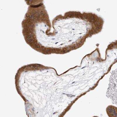 Immunohistochemistry: Ribophorin I Antibody [NBP1-82467] - Staining of human placenta shows strong cytoplasmic positivity in trophoblastic cells.