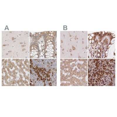 <b>Independent Antibodies Validation. </b>Immunohistochemistry-Paraffin: Ribophorin I Antibody [NBP1-82467] - Staining of human cerebral cortex, colon, liver and tonsil using Anti-RPN1 antibody NBP1-82467 (A) shows similar protein distribution across tissues to independent antibody NBP2-55523 (B).