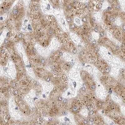 Immunohistochemistry-Paraffin: Ribophorin I Antibody [NBP1-82467] - Staining of human liver.