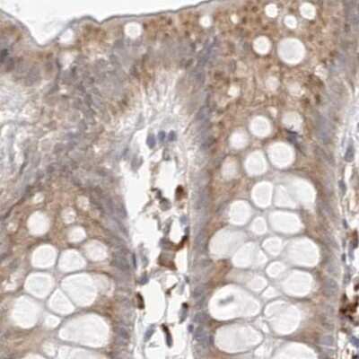 Immunohistochemistry-Paraffin: Ribophorin I Antibody [NBP1-82467] - Staining of human colon.