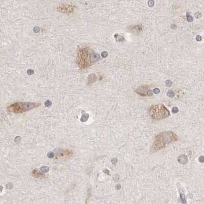 Immunohistochemistry-Paraffin: Ribophorin I Antibody [NBP1-82467] - Staining of human cerebral cortex.