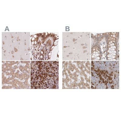 Immunohistochemistry-Paraffin Ribophorin I Antibody