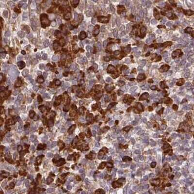 Immunohistochemistry-Paraffin: Ribophorin I Antibody [NBP2-55523] - Staining of human tonsil.