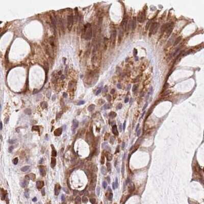 Immunohistochemistry-Paraffin: Ribophorin I Antibody [NBP2-55523] - Staining of human colon.