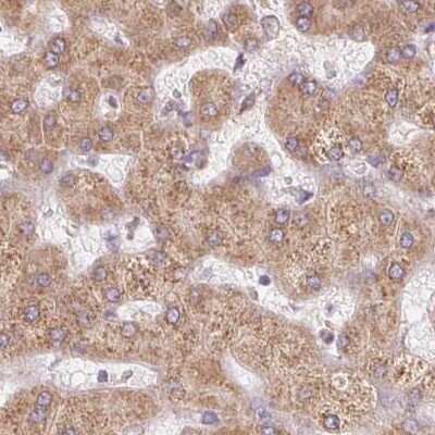 Immunohistochemistry-Paraffin: Ribophorin I Antibody [NBP2-55523] - Staining of human liver.