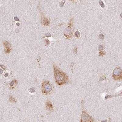 Immunohistochemistry-Paraffin: Ribophorin I Antibody [NBP2-55523] - Staining of human cerebral cortex.