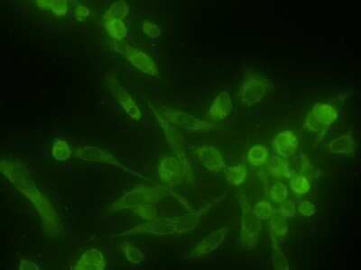 Immunocytochemistry/Immunofluorescence: Ribophorin I Antibody (OTI3H3) - Azide and BSA Free [NBP2-73898] - Expression of RPN1 on pica cell lines vs normal. Image from verified customer review.