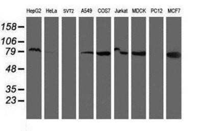 Western Blot: Ribophorin I Antibody (OTI3H3) - Azide and BSA Free [NBP2-73898] - Analysis of extracts (35ug) from 9 different cell lines by using anti-Ribophorin I monoclonal antibody.