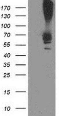 Western Blot: Ribophorin I Antibody (OTI3H3) - Azide and BSA Free [NBP2-73898] - HEK293T cells were transfected with the pCMV6-ENTRY control (Left lane) or pCMV6-ENTRY Ribophorin I (Right lane) cDNA for 48 hrs and lysed. Equivalent amounts of cell lysates (5 ug per lane) were separated by SDS-PAGE and immunoblotted with anti-Ribophori