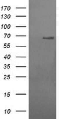 Western Blot: Ribophorin I Antibody (OTI5B1) - Azide and BSA Free [NBP2-73905] - Analysis of HEK293T cells were transfected with the pCMV6-ENTRY control (Left lane) or pCMV6-ENTRY Ribophorin I.