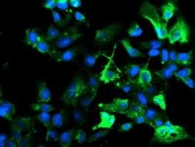 Immunofluorescence: Ribophorin I Antibody (OTI5B1) [NBP2-45633] - Analysis  of COS7 cells transiently transfected by pCMV6-ENTRY Ribophorin I.