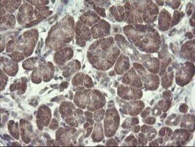 Immunohistochemistry: Ribophorin I Antibody (OTI5B1) [NBP2-45633] - Analysis of Human pancreas tissue. (Heat-induced epitope retrieval by 10mM citric buffer, pH6.0, 120C for 3min)