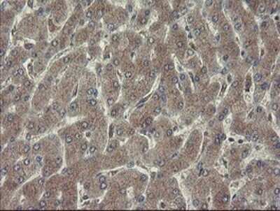 Immunohistochemistry: Ribophorin I Antibody (OTI5B1) [NBP2-45633] - Analysis of Human liver tissue. (Heat-induced epitope retrieval by 10mM citric buffer, pH6.0, 120C for 3min)