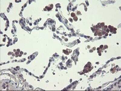 Immunohistochemistry: Ribophorin I Antibody (OTI5B1) [NBP2-45633] - Analysis of Human lung tissue. (Heat-induced epitope retrieval by 10mM citric buffer, pH6.0, 120C for 3min)