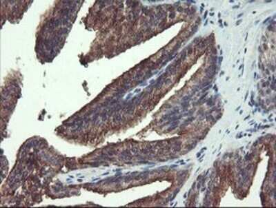 Immunohistochemistry: Ribophorin I Antibody (OTI5B1) [NBP2-45633] - Analysis of Human prostate tissue. (Heat-induced epitope retrieval by 10mM citric buffer, pH6.0, 120C for 3min)