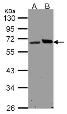 Western Blot: Ribophorin I Antibody [NBP1-32704] - Sample(30 ug of whole cell lysate)A:H1299 B:Hep G2 10% SDS PAGE, antibody diluted at 1:1500.