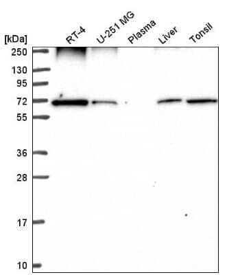 <b>Independent Antibodies Validation. </b>Western Blot: Ribophorin I Antibody [NBP2-55523] - Analysis in human cell line RT-4, human cell line U-251 MG, human plasma, human liver tissue and human tonsil tissue.