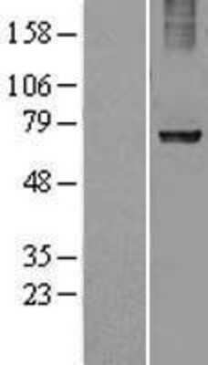 Western Blot: Ribophorin I Overexpression Lysate (Adult Normal) [NBL1-15550] Left-Empty vector transfected control cell lysate (HEK293 cell lysate); Right -Over-expression Lysate for Ribophorin I.