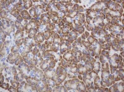 Immunohistochemistry: Ribophorin II Antibody (1G9) [NBP2-45963] - Analysis of Human pancreas tissue. (Heat-induced epitope retrieval by 10mM citric buffer, pH6.0, 120C for 3min)