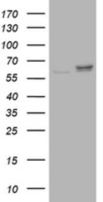 Western Blot: Ribophorin II Antibody (1G9) [NBP2-45963] - Analysis of HEK293T cells were transfected with the pCMV6-ENTRY control (Left lane) or pCMV6-ENTRY Ribophorin II.