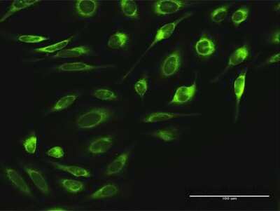 Immunocytochemistry/Immunofluorescence: Ribophorin II Antibody [H00006185-D01P] - Analysis of antibody to RPN2 on HeLa cell. Antibody concentration 10 ug/ml.