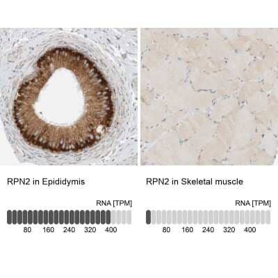 Immunohistochemistry-Paraffin: Ribophorin II Antibody [NBP1-80835] - Staining in human epididymis and skeletal muscle tissues using NBP1-80835 antibody. Corresponding RPN2 RNA-seq data are presented for the same tissues.