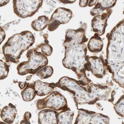 Immunohistochemistry-Paraffin: Ribophorin II Antibody [NBP1-80835] - Staining of human placenta shows strong granular cytoplasmic positivity in trophoblastic cells.