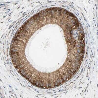 <b>Orthogonal Strategies Validation. </b>Immunohistochemistry-Paraffin: Ribophorin II Antibody [NBP1-80836] - Staining of human epididymis shows high expression.