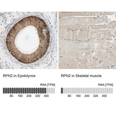 Immunohistochemistry-Paraffin: Ribophorin II Antibody [NBP1-80836] - Staining in human epididymis and skeletal muscle tissues using anti-RPN2 antibody. Corresponding RPN2 RNA-seq data are presented for the same tissues.