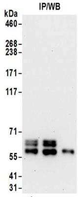 Immunoprecipitation: Ribophorin II Antibody [NBP2-32178] - Samples:  Whole cell lysate (0.5 or 1.0 mg per IP reaction; 20% of IP loaded) from HeLa cells.  Antibodies:  Affinity purified rabbit anti-Ribophorin II antibody NBP2-32178 used for IP at 6 ug per reaction. Ribophorin II was also immunoprecipitated by rabbit anti-Ribophorin II antibody BL15802.  For blotting immunoprecipitated Ribophorin II, NBP2-32178 was used at 1 ug/ml.  Detection: Chemiluminescence with an exposure time of 30 seconds.