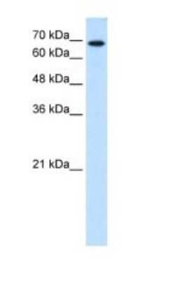 Western Blot: Ribophorin II Antibody [NBP1-62480] - Titration: 0.25ug/ml Positive Control: HepG2 cell lysate.