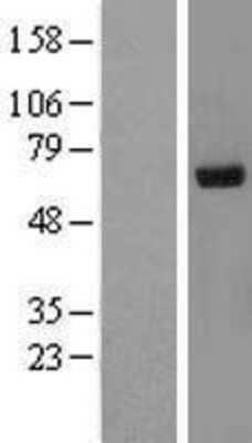 Western Blot: Ribophorin II Overexpression Lysate (Adult Normal) [NBL1-15551] - Western Blot experiments.  Left-Control; Right -Over-expression Lysate for RPN2