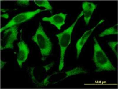 Immunocytochemistry/Immunofluorescence: Ribosomal Protein L17 Antibody (3G11) [H00006139-M01] - Analysis of monoclonal antibody to RPL17 on HeLa cell . Antibody concentration 10 ug/ml.