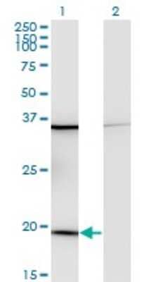 Western Blot: Ribosomal Protein L17 Antibody (3G11) [H00006139-M01] - Analysis of RPL17 expression in transfected 293T cell line by RPL17 monoclonal antibody (M01), clone 3G11.Lane 1: RPL17 transfected lysate(21.4 KDa).Lane 2: Non-transfected lysate.