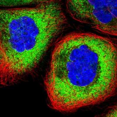 Immunocytochemistry/Immunofluorescence: Ribosomal Protein L17 Antibody [NBP2-48798] - Staining of human cell line A-431 shows localization to cytosol & endoplasmic reticulum.