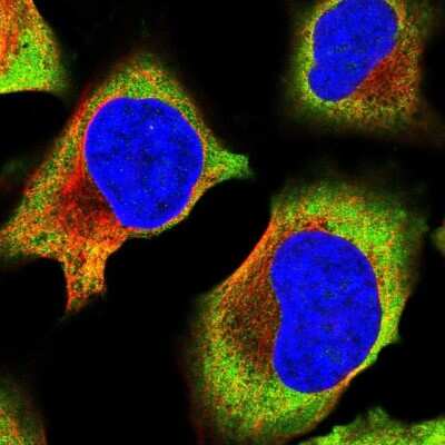 Immunocytochemistry/Immunofluorescence: Ribosomal Protein L17 Antibody [NBP2-48845] - Staining of human cell line U-2 OS shows localization to nucleoli, cytosol & endoplasmic reticulum.