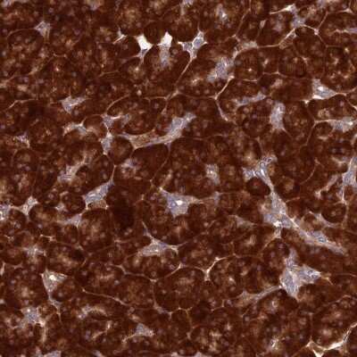 Immunohistochemistry: Ribosomal Protein L17 Antibody [NBP2-48798] - Staining of human pancreas shows strong cytoplasmic positivity in exocrine glandular cells.